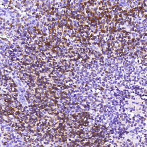 CD79A
