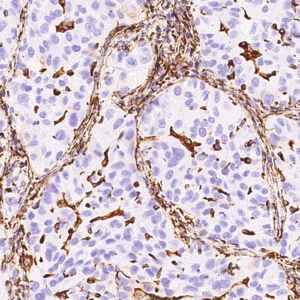 Vimentin