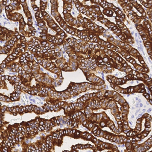 Cytokeratin 19