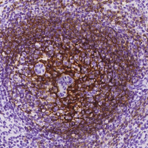 CD21