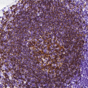 Anti-CD20 Antibody