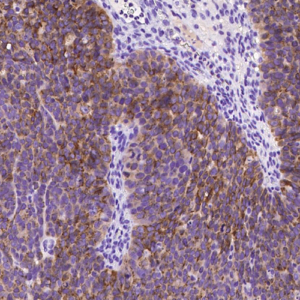 Anti-MSLN Antibody